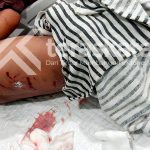 Bocah diterkam buaya