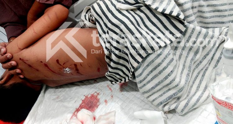 Bocah diterkam buaya