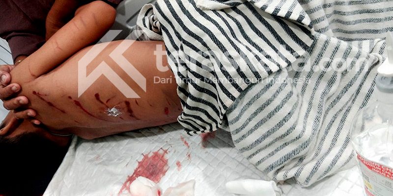 Bocah diterkam buaya