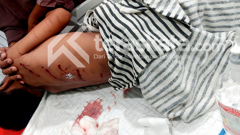 Bocah diterkam buaya